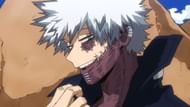 Dabi as seen in the anime (Image via Studio Bones)